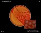 Streptococcus pyogenes large colonies